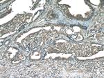 TMEFF2 Antibody in Immunohistochemistry (Paraffin) (IHC (P))