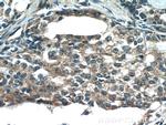 TMEFF2 Antibody in Immunohistochemistry (Paraffin) (IHC (P))