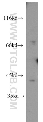 TMEFF2 Antibody in Western Blot (WB)