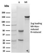 Alpha-1-Antichymotrypsin (SERPINA3) (Histiocytoma Marker) Antibody in Immunoelectrophoresis (IE)