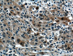 NUSAP1 Antibody in Immunohistochemistry (Paraffin) (IHC (P))