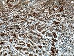 NUSAP1 Antibody in Immunohistochemistry (Paraffin) (IHC (P))