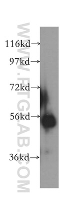 NUSAP1 Antibody in Western Blot (WB)