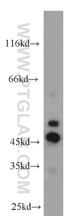 NUSAP1 Antibody in Western Blot (WB)