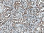 DVL2 Antibody in Immunohistochemistry (Paraffin) (IHC (P))