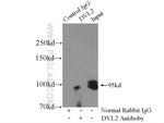 DVL2 Antibody in Immunoprecipitation (IP)