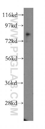 CD164 Antibody in Western Blot (WB)