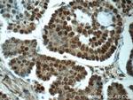 SPIN1 Antibody in Immunohistochemistry (Paraffin) (IHC (P))