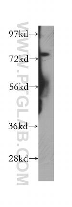 PHF21A Antibody in Western Blot (WB)