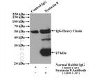 Syntaxin 8 Antibody in Immunoprecipitation (IP)