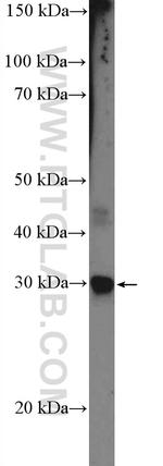 CIDEC Antibody in Western Blot (WB)