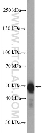 PAX6 Antibody in Western Blot (WB)