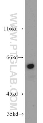 TRIP4 Antibody in Western Blot (WB)