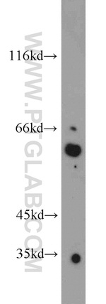 TRIP4 Antibody in Western Blot (WB)