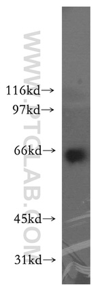 TRIP4 Antibody in Western Blot (WB)