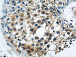 DYNC1H1 Antibody in Immunohistochemistry (Paraffin) (IHC (P))