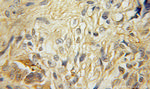 RAB40B Antibody in Immunohistochemistry (Paraffin) (IHC (P))