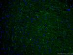 AK5 Antibody in Immunohistochemistry (PFA fixed) (IHC (PFA))