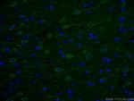 AK5 Antibody in Immunohistochemistry (PFA fixed) (IHC (PFA))