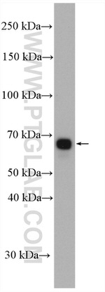 AK5 Antibody in Western Blot (WB)