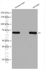 AK5 Antibody in Western Blot (WB)