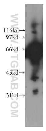 AK5 Antibody in Western Blot (WB)