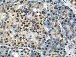 PTBP1 Antibody in Immunohistochemistry (Paraffin) (IHC (P))