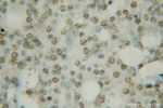 PTBP1 Antibody in Immunohistochemistry (Paraffin) (IHC (P))