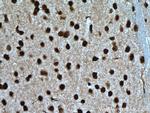 PTBP1 Antibody in Immunohistochemistry (Paraffin) (IHC (P))