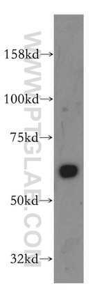 PTBP1 Antibody in Western Blot (WB)