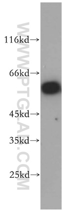 PTBP1 Antibody in Western Blot (WB)