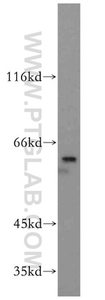 PTBP1 Antibody in Western Blot (WB)