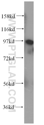 golgin 97 Antibody in Western Blot (WB)