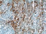 HABP2 Antibody in Immunohistochemistry (Paraffin) (IHC (P))