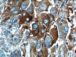 HABP2 Antibody in Immunohistochemistry (Paraffin) (IHC (P))