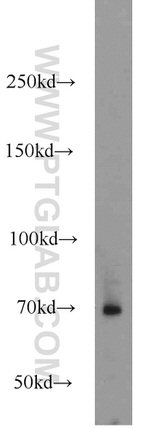 AOAH Antibody in Western Blot (WB)