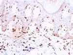 Collagen VII Antibody in Immunohistochemistry (Paraffin) (IHC (P))