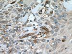 SLC27A3 Antibody in Immunohistochemistry (Paraffin) (IHC (P))