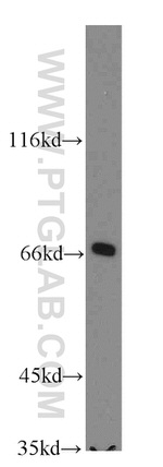 SLC27A3 Antibody in Western Blot (WB)