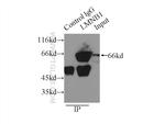 Lamin B1 Antibody in Immunoprecipitation (IP)