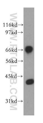 Lamin B1 Antibody in Western Blot (WB)