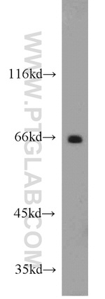 Lamin B1 Antibody in Western Blot (WB)