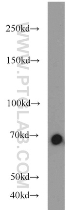 Lamin B1 Antibody in Western Blot (WB)