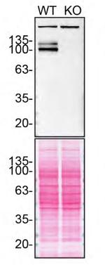 Amyloid Precursor Protein Antibody in Western Blot (WB)