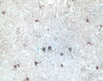 ERK1/ERK2 Antibody in Immunohistochemistry (IHC)