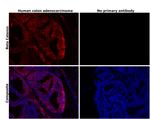 beta Catenin Antibody in Immunohistochemistry (Paraffin) (IHC (P))