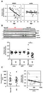 Amyloid Precursor Protein Antibody in Western Blot (WB)