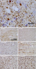 Amyloid Precursor Protein Antibody in Immunohistochemistry (Paraffin) (IHC (P))