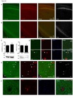 Amyloid Precursor Protein Antibody in Immunocytochemistry (ICC/IF)