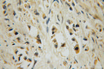 15 Lipoxygenase 2 Antibody in Immunohistochemistry (Paraffin) (IHC (P))